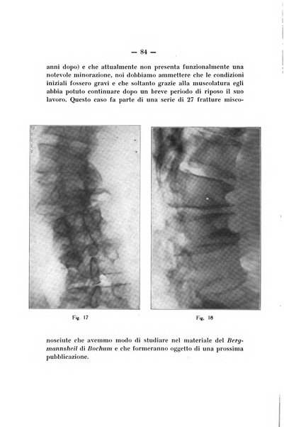 Archivio di ortopedia pubblicazione ufficiale del Pio istituto dei rachitici <1924-1950>