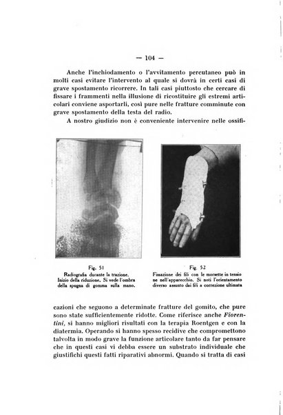 Archivio di ortopedia pubblicazione ufficiale del Pio istituto dei rachitici <1924-1950>