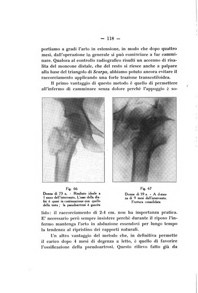 Archivio di ortopedia pubblicazione ufficiale del Pio istituto dei rachitici <1924-1950>