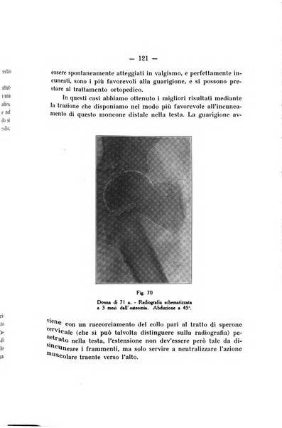 Archivio di ortopedia pubblicazione ufficiale del Pio istituto dei rachitici <1924-1950>