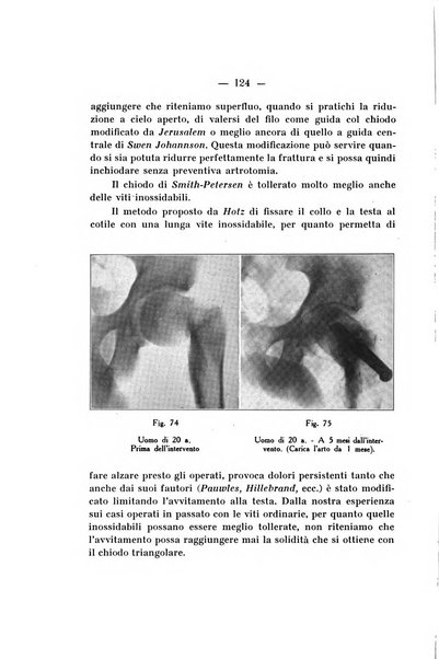 Archivio di ortopedia pubblicazione ufficiale del Pio istituto dei rachitici <1924-1950>