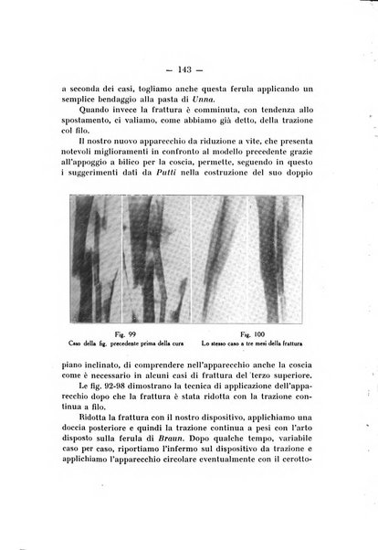 Archivio di ortopedia pubblicazione ufficiale del Pio istituto dei rachitici <1924-1950>