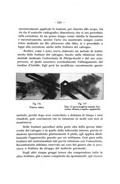 Archivio di ortopedia pubblicazione ufficiale del Pio istituto dei rachitici <1924-1950>