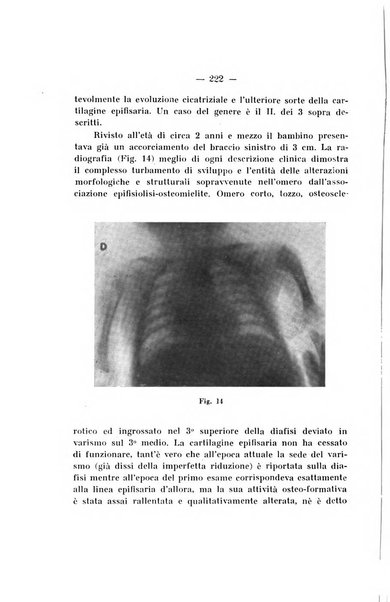 Archivio di ortopedia pubblicazione ufficiale del Pio istituto dei rachitici <1924-1950>