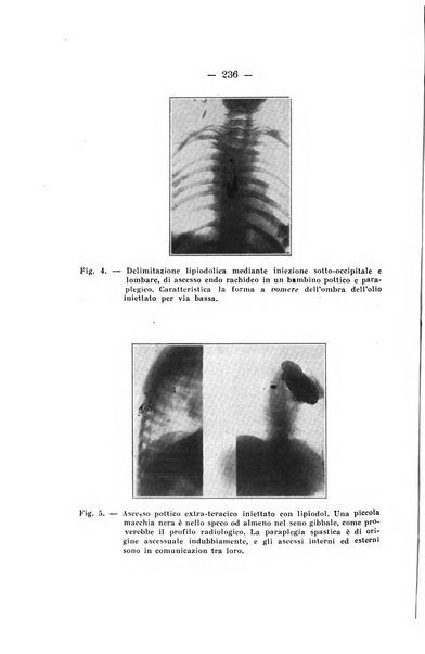 Archivio di ortopedia pubblicazione ufficiale del Pio istituto dei rachitici <1924-1950>