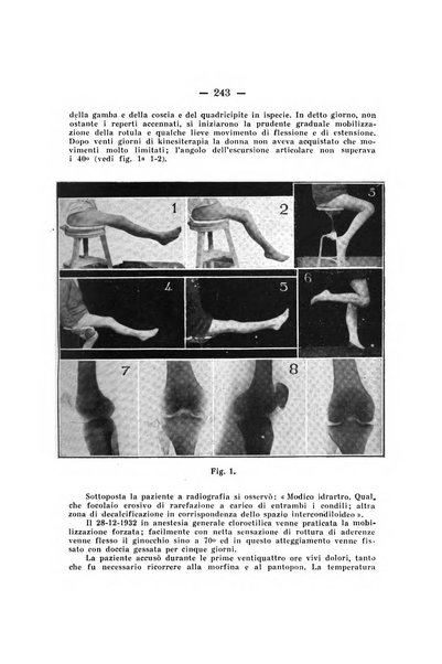 Archivio di ortopedia pubblicazione ufficiale del Pio istituto dei rachitici <1924-1950>