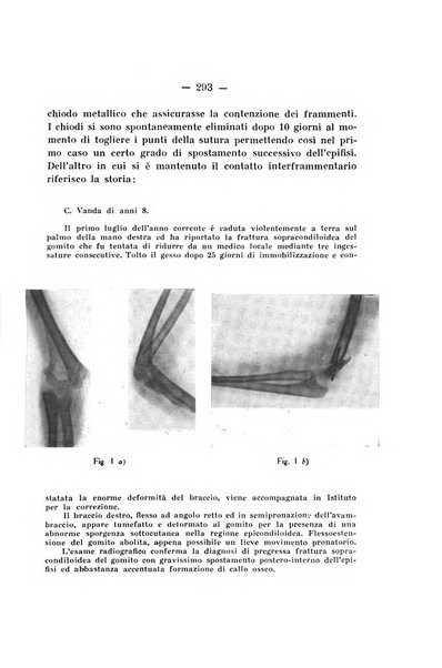 Archivio di ortopedia pubblicazione ufficiale del Pio istituto dei rachitici <1924-1950>