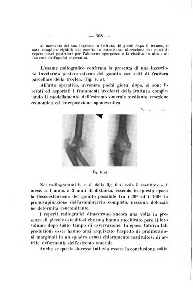 Archivio di ortopedia pubblicazione ufficiale del Pio istituto dei rachitici <1924-1950>