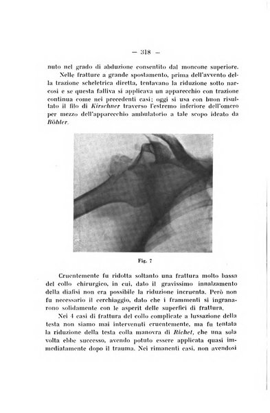 Archivio di ortopedia pubblicazione ufficiale del Pio istituto dei rachitici <1924-1950>