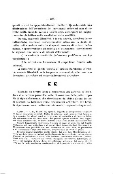 Archivio di ortopedia pubblicazione ufficiale del Pio istituto dei rachitici <1924-1950>