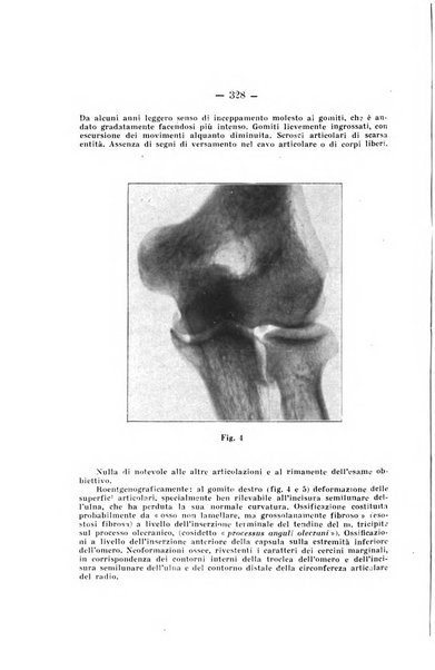 Archivio di ortopedia pubblicazione ufficiale del Pio istituto dei rachitici <1924-1950>