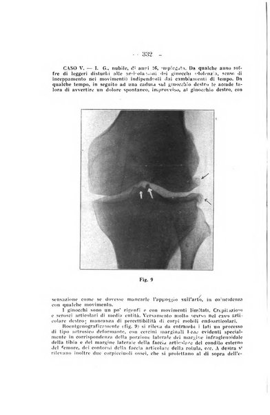 Archivio di ortopedia pubblicazione ufficiale del Pio istituto dei rachitici <1924-1950>