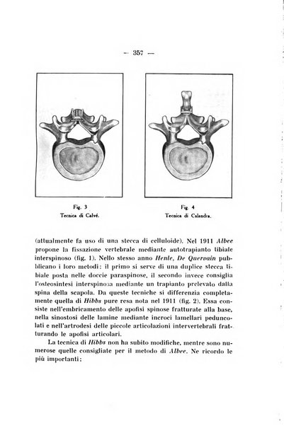 Archivio di ortopedia pubblicazione ufficiale del Pio istituto dei rachitici <1924-1950>