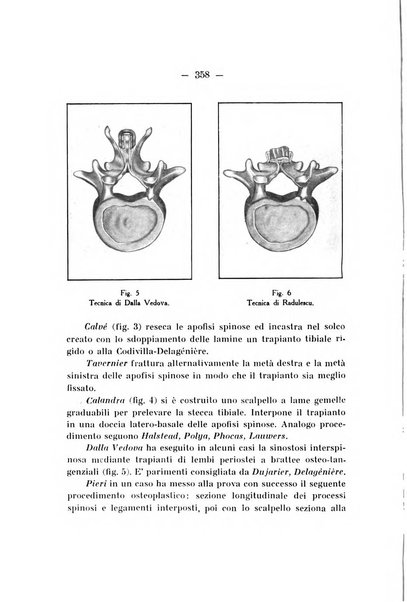 Archivio di ortopedia pubblicazione ufficiale del Pio istituto dei rachitici <1924-1950>