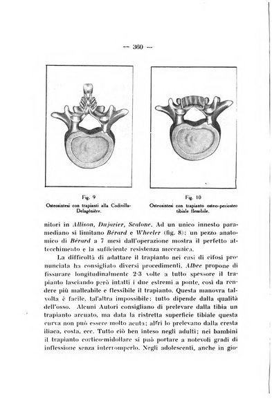 Archivio di ortopedia pubblicazione ufficiale del Pio istituto dei rachitici <1924-1950>