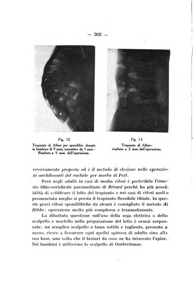 Archivio di ortopedia pubblicazione ufficiale del Pio istituto dei rachitici <1924-1950>