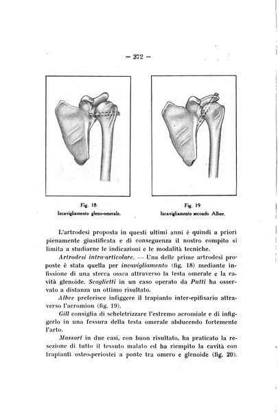 Archivio di ortopedia pubblicazione ufficiale del Pio istituto dei rachitici <1924-1950>