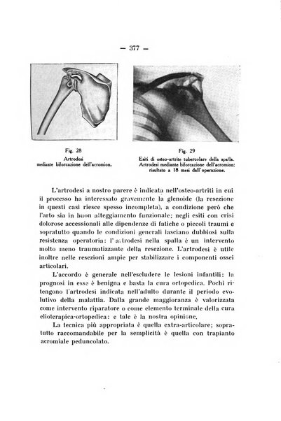 Archivio di ortopedia pubblicazione ufficiale del Pio istituto dei rachitici <1924-1950>