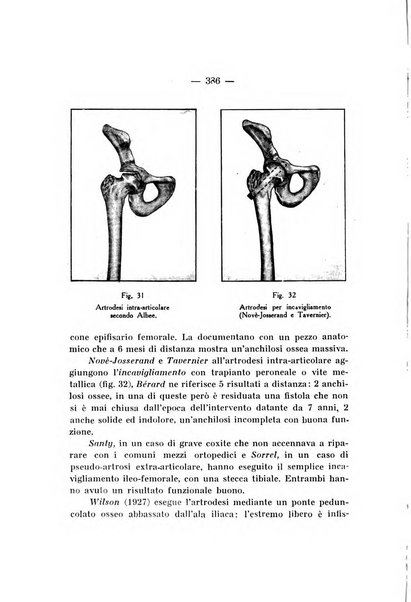 Archivio di ortopedia pubblicazione ufficiale del Pio istituto dei rachitici <1924-1950>