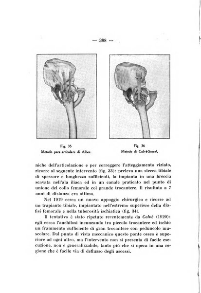 Archivio di ortopedia pubblicazione ufficiale del Pio istituto dei rachitici <1924-1950>