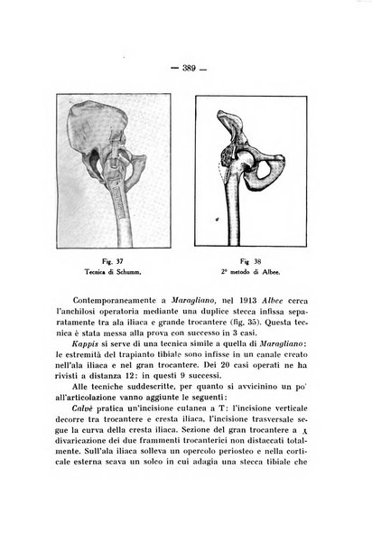 Archivio di ortopedia pubblicazione ufficiale del Pio istituto dei rachitici <1924-1950>