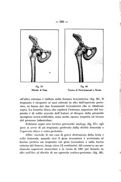 Archivio di ortopedia pubblicazione ufficiale del Pio istituto dei rachitici <1924-1950>