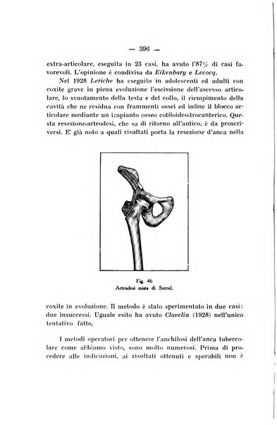 Archivio di ortopedia pubblicazione ufficiale del Pio istituto dei rachitici <1924-1950>