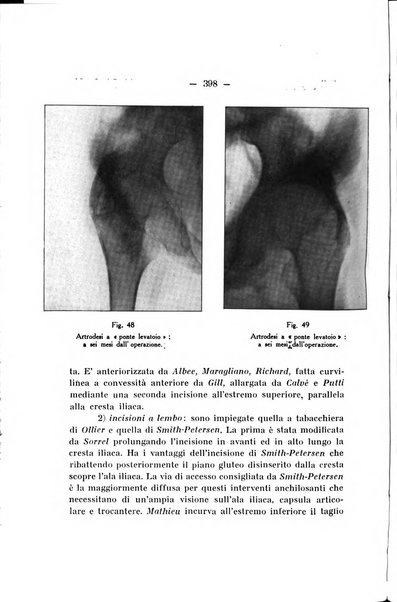 Archivio di ortopedia pubblicazione ufficiale del Pio istituto dei rachitici <1924-1950>