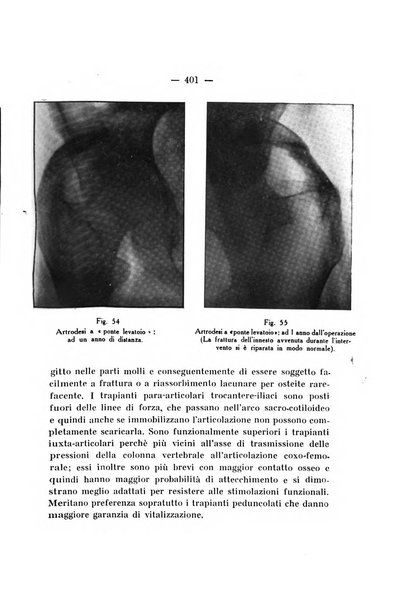 Archivio di ortopedia pubblicazione ufficiale del Pio istituto dei rachitici <1924-1950>