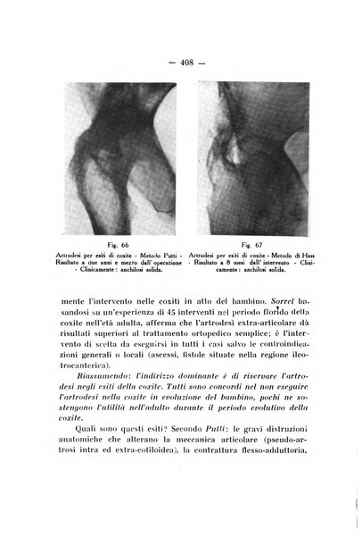 Archivio di ortopedia pubblicazione ufficiale del Pio istituto dei rachitici <1924-1950>