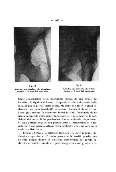 Archivio di ortopedia pubblicazione ufficiale del Pio istituto dei rachitici <1924-1950>