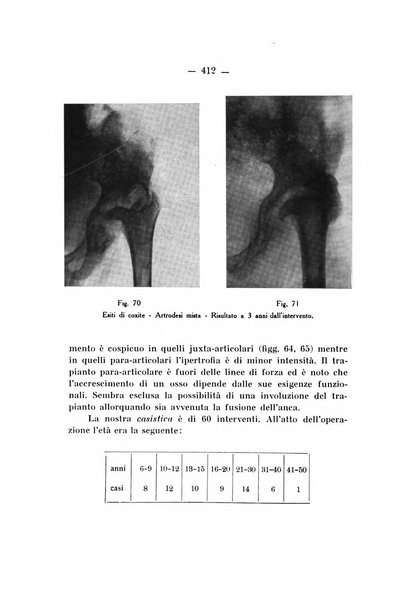 Archivio di ortopedia pubblicazione ufficiale del Pio istituto dei rachitici <1924-1950>