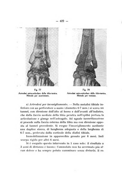 Archivio di ortopedia pubblicazione ufficiale del Pio istituto dei rachitici <1924-1950>