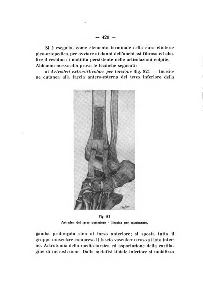 Archivio di ortopedia pubblicazione ufficiale del Pio istituto dei rachitici <1924-1950>