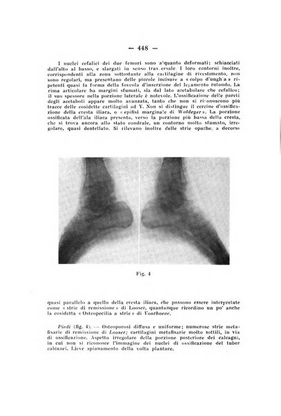 Archivio di ortopedia pubblicazione ufficiale del Pio istituto dei rachitici <1924-1950>