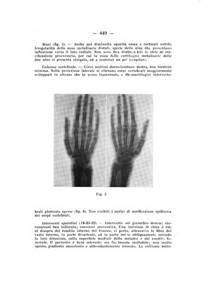 Archivio di ortopedia pubblicazione ufficiale del Pio istituto dei rachitici <1924-1950>