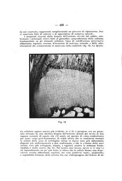 Archivio di ortopedia pubblicazione ufficiale del Pio istituto dei rachitici <1924-1950>