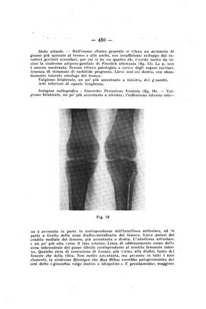 Archivio di ortopedia pubblicazione ufficiale del Pio istituto dei rachitici <1924-1950>