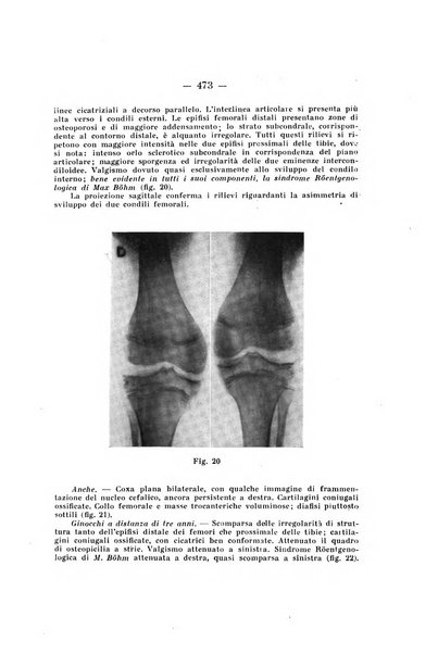 Archivio di ortopedia pubblicazione ufficiale del Pio istituto dei rachitici <1924-1950>