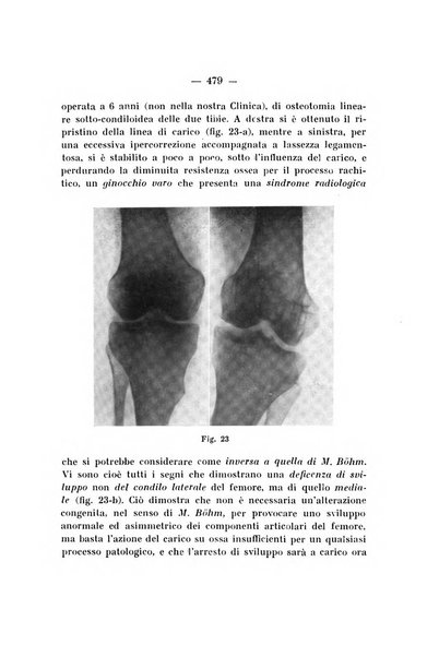 Archivio di ortopedia pubblicazione ufficiale del Pio istituto dei rachitici <1924-1950>