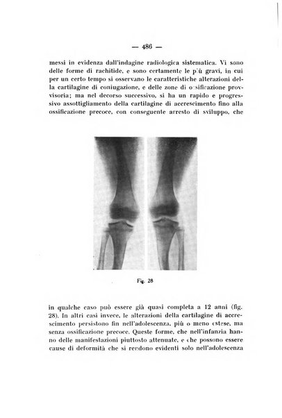 Archivio di ortopedia pubblicazione ufficiale del Pio istituto dei rachitici <1924-1950>