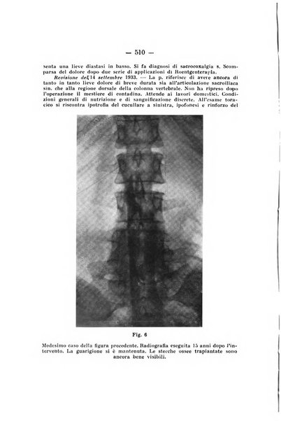 Archivio di ortopedia pubblicazione ufficiale del Pio istituto dei rachitici <1924-1950>