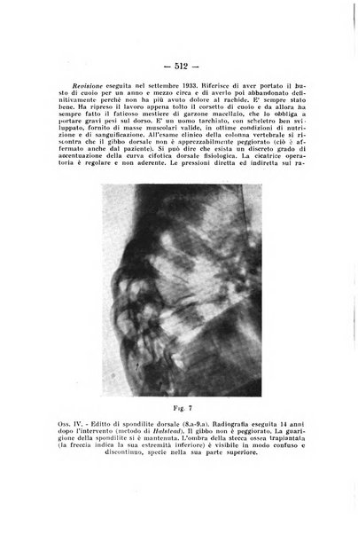 Archivio di ortopedia pubblicazione ufficiale del Pio istituto dei rachitici <1924-1950>