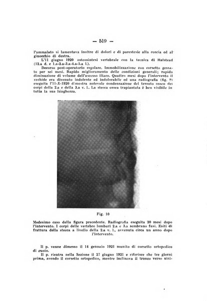 Archivio di ortopedia pubblicazione ufficiale del Pio istituto dei rachitici <1924-1950>