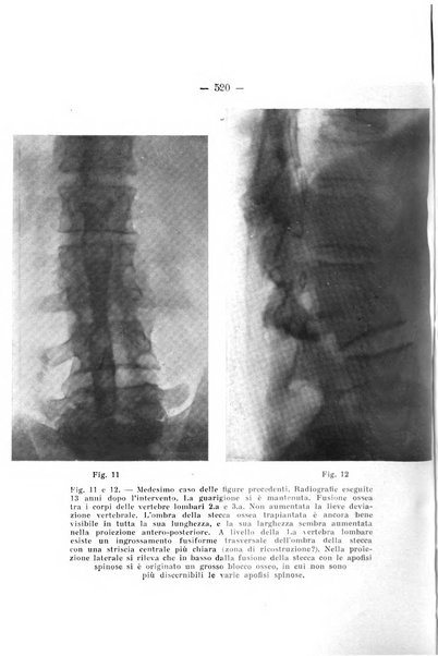 Archivio di ortopedia pubblicazione ufficiale del Pio istituto dei rachitici <1924-1950>