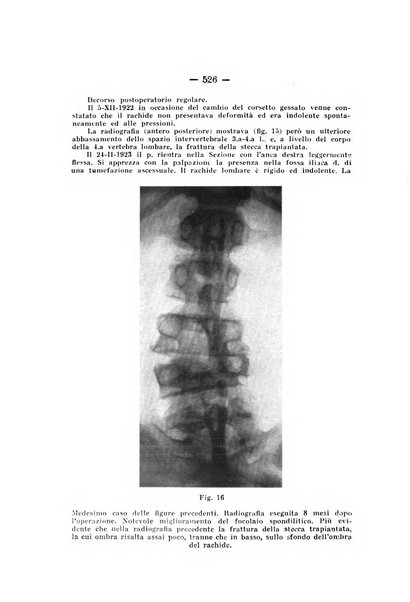 Archivio di ortopedia pubblicazione ufficiale del Pio istituto dei rachitici <1924-1950>