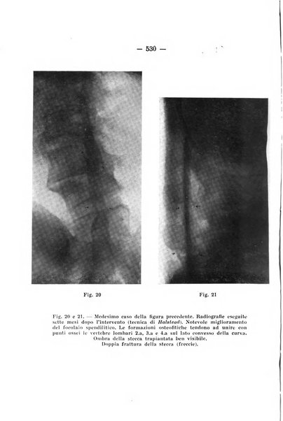 Archivio di ortopedia pubblicazione ufficiale del Pio istituto dei rachitici <1924-1950>