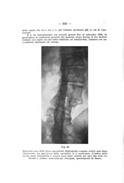 Archivio di ortopedia pubblicazione ufficiale del Pio istituto dei rachitici <1924-1950>