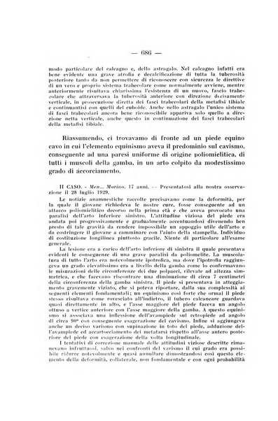 Archivio di ortopedia pubblicazione ufficiale del Pio istituto dei rachitici <1924-1950>