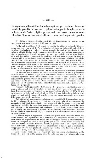 Archivio di ortopedia pubblicazione ufficiale del Pio istituto dei rachitici <1924-1950>